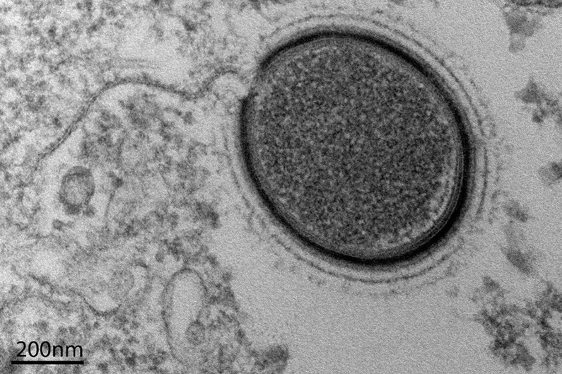 Découverte d'un virus géant vieux de 30 000 ans en Russie